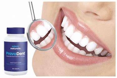 ProvaDent support optimal dental health